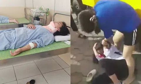 Nữ sinh lớp 8 ở Hà Nội bị bạn đánh đến chấn thương đốt sống cổ