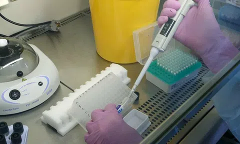 Nga: Phát hiện người phụ nữ mang 18 biến thể của SARS-CoV-2