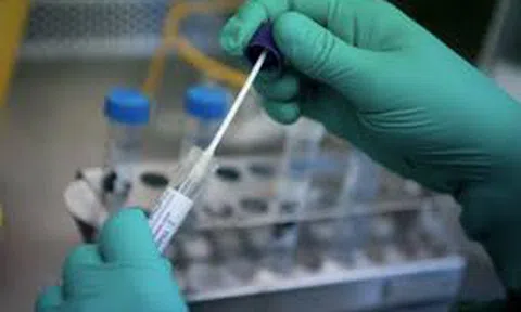 Phó giám đốc CDC Hà Nội: 5.000 người ở Hà Nội phải xét nghiệm SARS-CoV-2 khẩn cấp