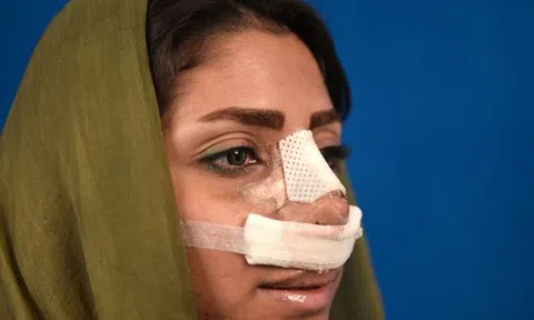 Iran ban hành lệnh cấm bác sĩ nam phẫu thuật thẩm mỹ cho nữ bệnh nhân