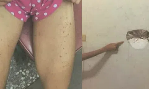 Bé gái 10 tuổi bị khách thuê trọ bạo hành