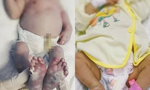 Mối nguy hiểm khi trẻ sơ sinh mắc 'bệnh người lớn'