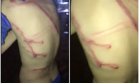 Con phạm lỗi, cha đánh bằng dây điện: Bạo hành hay dạy dỗ?