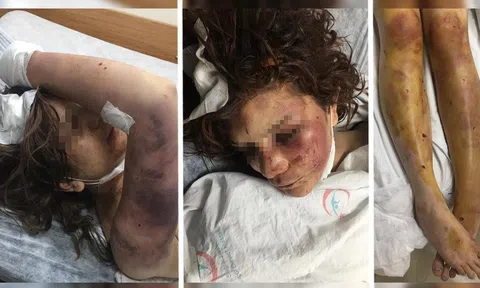 Bắt khẩn cấp “quái vật” bắt nhốt vợ trong “nhà tù tự chế” để tra tấn, đánh đập