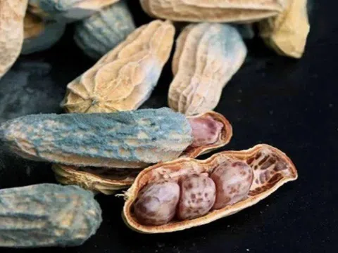 Vị bác sĩ 54 tuổi bất ngờ phát hiện ung thư, "thủ phạm" là loại hạt ông thường mang theo để ăn chống đói