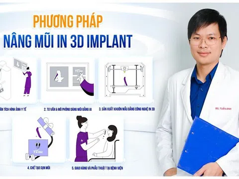 Bác sĩ Nguyễn Tuấn Anh ứng dụng thành công công nghệ nâng mũi In 3D Implant