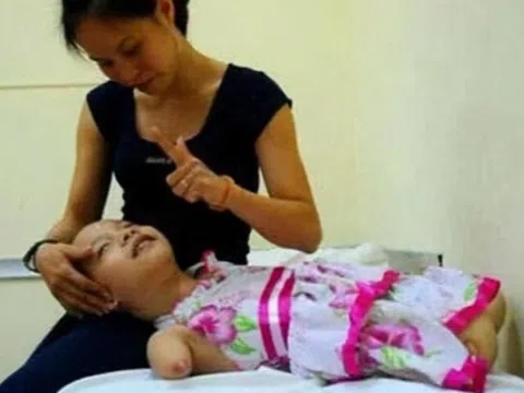Mẹ quyết sinh con không có tay chân dù gia đình nội chối bỏ, đứa trẻ càng lớn càng xinh như thiên thần