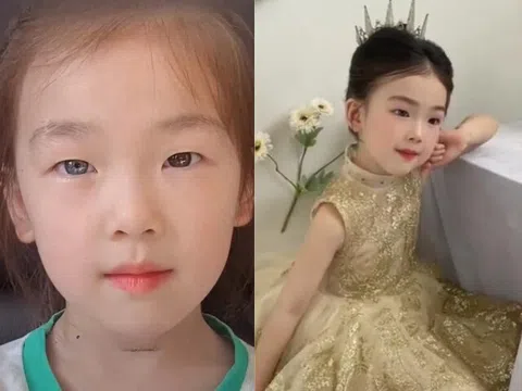 Bé gái 6 tuổi nổi tiếng sau một đêm vì có đôi mắt “kỳ lạ”, gia đình bật khóc khi nghe bác sĩ kết luận