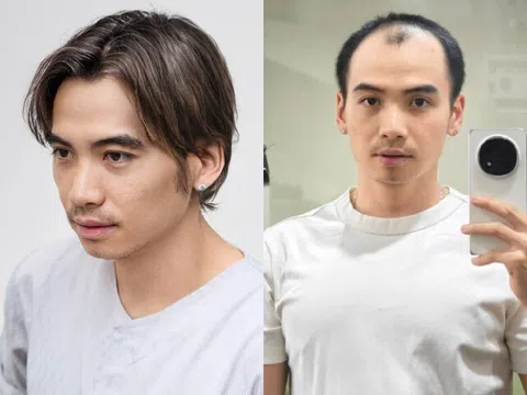 Chồng H'Hen Niê khoe giao diện mới hậu phẫu thuật ngoại hình, hết cảnh tự ti khi sánh đôi bên vợ hoa hậu