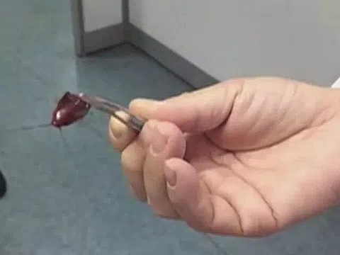 Con gái mẫu giáo bị một sinh vật lạ chui vào tai, chỉ với một hành động người mẹ được bác sĩ khen “Rất thông minh”