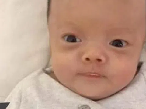 Bé sơ sinh chào đời có diện mạo như “ông già” suýt bị bỏ rơi, giờ đứa trẻ “lột xác” khiến mẹ ngỡ ngàng