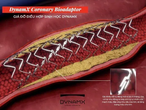 Stent tương thích sinh học thế hệ mới giảm biến chứng tim mạch đáng kể so với stent phủ thuốc hiện đại