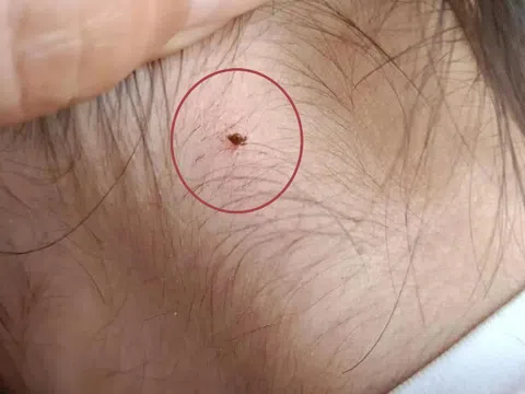 Phát hiện sinh vật lạ cắn vào cổ con gái 4 tuổi, người mẹ vẫn “từ chối” hai lần cứu con và cái kết không ngờ