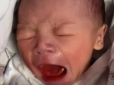 Mẹ bật khóc vì con chào đời quá xấu xí, 4 năm sau đứa trẻ đẹp như em bé lai, làm mẫu nhí đắt show
