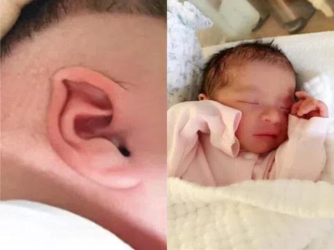 Bé trai sinh ra có đôi tai “biến dạng”, gia đình lo lắng đưa đến bệnh viện, nghe bác sĩ nói người mẹ bật khóc