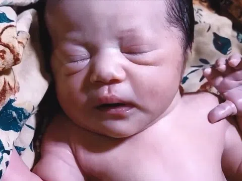 Con sơ sinh chào đời 7 ngày vẫn chưa mở mắt, tưởng con gặp vấn đề mẹ liền đưa đến bệnh viện, kết quả không ngờ