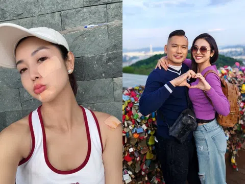 Hoa hậu Jennifer Phạm trầy hết nửa mặt vì ngã khi chơi pickleball, dân mạng bày tỏ "không phải chồng mà nhìn còn xót"