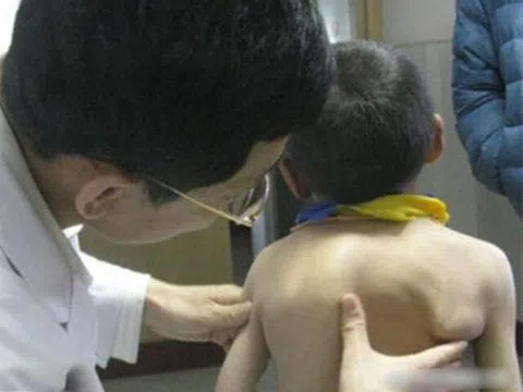 Mẹ phát hiện lưng con ngày càng biến dạng, biết nguyên nhân do thói quen của bà nội, người mẹ hối hận