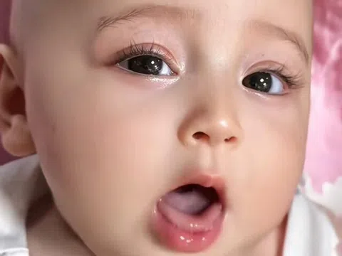 Bé gái sơ sinh có khuôn mặt đẹp như tiên tử, cõi mạng trầm trồ “đứa trẻ đã phẫu thuật thẩm mỹ”