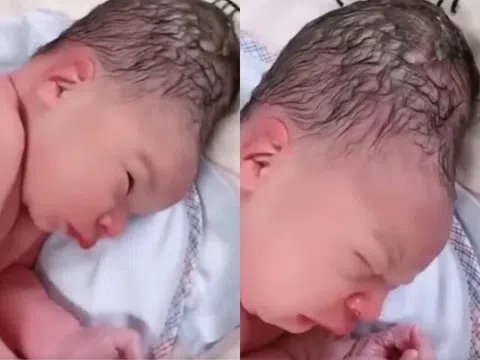 Bé sơ sinh chào đời có hình dáng đầu kỳ lạ, gia đình vừa nhìn thấy đứa trẻ đã sợ không dám bế