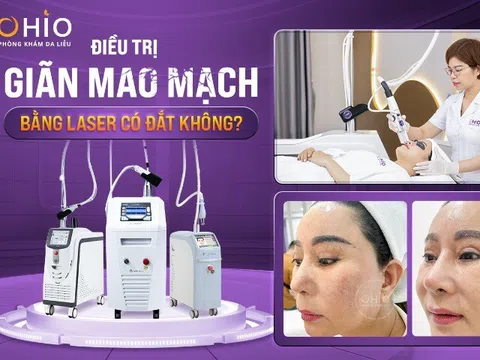 Điều trị giãn mao mạch bằng laser có đắt không?