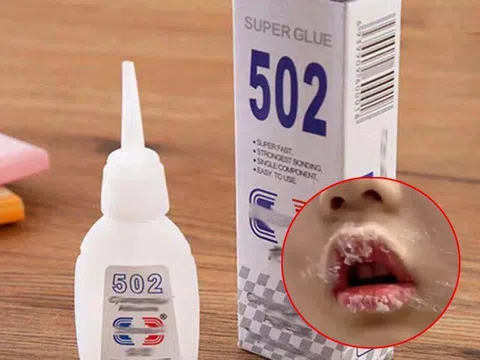 Con nếm thử keo 502 bị dính chặt môi, mẹ bình tĩnh xử lý thông minh khiến bác sĩ cũng phải khen ngợi