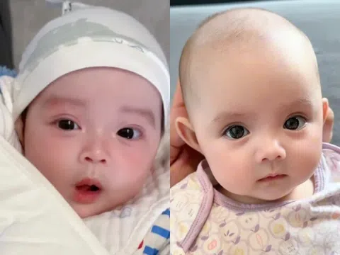Loạt ảnh chào đời "gây rúng động" của những em bé sơ sinh, đẹp như tạc tượng khiến bác sĩ cũng ngỡ ngàng