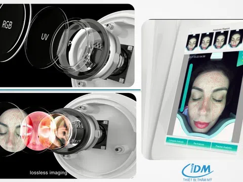 Trải nghiệm soi da AI: Bí quyết phát hiện nám sớm tại thẩm mỹ viện Ngọc Dung