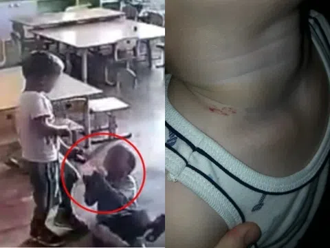 Đón con đi học về thì phát hiện trên cổ bé có vết bầm, kiểm tra camera người mẹ bủn rủn với cảnh tượng giữa lớp