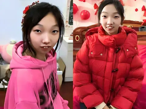 Cô gái ngoại hình khác lạ, cười ngô nghê khi được mẹ ruột chọn chồng và giục sinh con khiến MXH bùng nổ