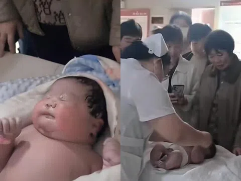 Bé sơ sinh chào đời da vừa đỏ vừa tím, nặng 7kg, y tá bế khỏi phòng mổ cả gia đình hoang mang