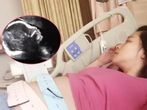 Mẹ bầu đến bệnh viện khám thai mỗi lần đều cho kết quả khác nhau, tá hoả khi nghe bác sĩ kết luận sinh 4 con