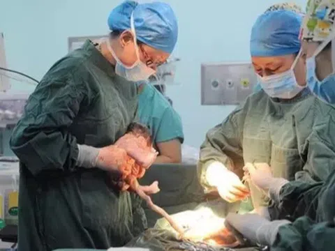 Đang đỡ đẻ cho sản phụ, bác sĩ bỗng hô lên: "Bố nhanh chụp ảnh! Con anh là một phép màu"