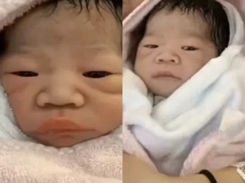 Bé gái chào đời bị họ hàng chê xấu dù bố mẹ đẹp, vài tháng sau lột xác nhận không ra