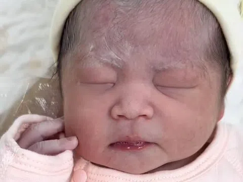 Con sinh 3 ngày vẫn không chịu mở mắt, nhận kết quả khám của bác sĩ bố mẹ mới biết do di truyền