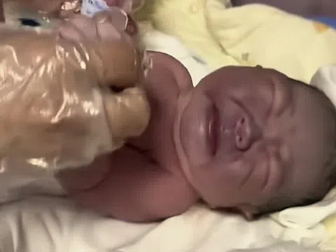 Bà bầu muốn con trắng trẻo nên ngày nào cũng ăn một thứ, phát hoảng khi đứa trẻ chào đời da tím sẫm, nặng 4kg