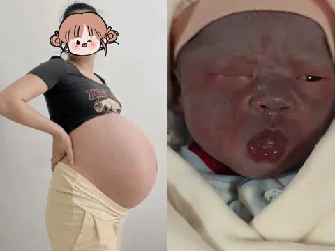 Bà bầu mang thai 33 tuần bị đau lưng, bác sĩ hoảng hốt khám: "Phẫu thuật ngay, nếu không cả mẹ và con đều khó sống"