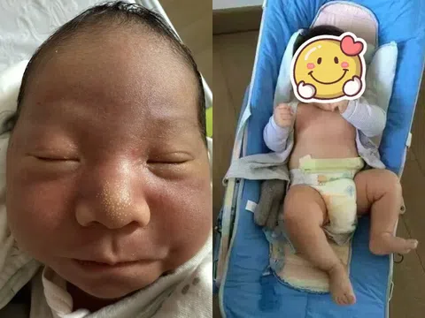 Rời bàn đẻ, mẹ bỉm bật khóc khi thấy con sơ sinh chào đời quá xấu, 3 tháng sau hãnh diện khoe khắp MXH