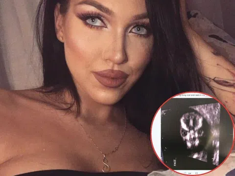 Mẹ bầu khoe ảnh siêu âm của con lên mạng, nhiều người nhìn thấy liền khuyên em bé "có vấn đề" và cái kết