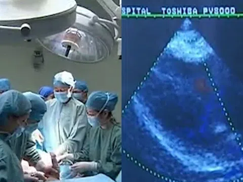 Mang thai 8 tháng, mẹ bầu nhập viện sinh mổ nhưng bác sĩ không thấy thai nhi đâu, lý do khiến nhiều người sợ hãi