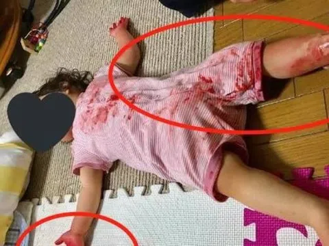 Ra ngoài 10 phút trở về, vừa mở cửa nhà thấy con gái người dính “đầy máu”, người mẹ suýt ngất