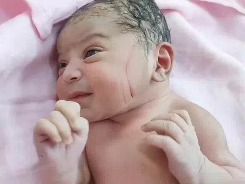 Vừa rời phòng đẻ phát hiện nhiều vết thương trên mặt con sơ sinh, gia đình nghi ngờ bác sĩ tắc trách, đòi kiện