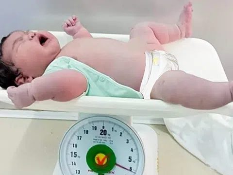 Bé gái sơ sinh chào đời với cân nặng 6,2kg