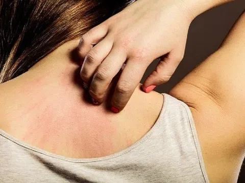 Đi khám vì ngứa ngáy, người phụ nữ bất ngờ với chẩn đoán của bác sĩ
