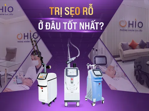 Trị sẹo rỗ ở đâu tốt nhất? phòng khám da liễu OHIO – lựa chọn hàng đầu cho làn da sẹo rỗ, sẹo mụn với phác đồ Pulse Scar