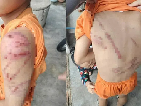 Phẫn nộ hình ảnh bé trai 10 tuổi bị cha ruột đánh đập lan truyền mạng xã hội
