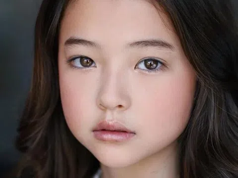 Từng là “em bé đẹp nhất thế giới”, nhan sắc tuổi 18 của Ella Gross vẫn đẹp như thiên thần