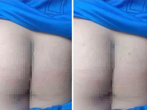 Vụ phụ huynh vào trường đánh học sinh 10 roi theo "giao kèo": Cà Mau chỉ đạo làm rõ