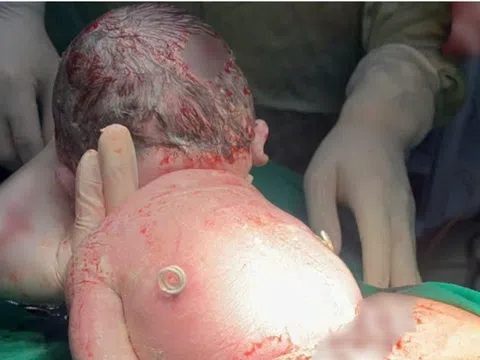 Em bé sống sót nhờ “đôi cánh” đặc biệt trên lưng từ trong bụng mẹ