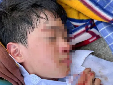 Vụ nam sinh lớp 6 chảy máu đầu gây xôn xao: Công an lên tiếng về nguyên nhân